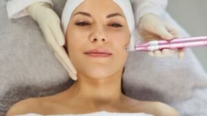 Dermapen con ácido hialurónico